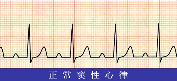 救命神器AED有多重要——你認識它嗎？(pic6)